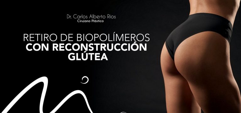 retiro-biopolimeros-reconstruccion-glutea