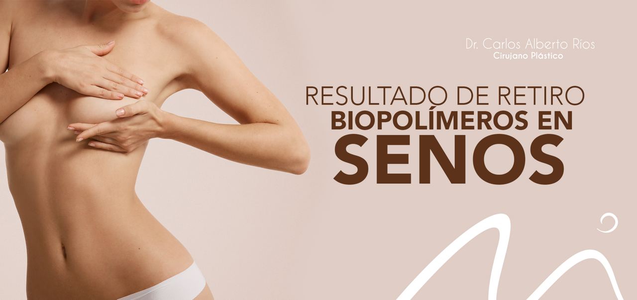 biopolimeros- senos