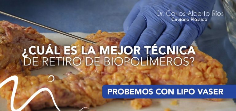 cual-mejor-tecnica-para-retiro-biopolimeros