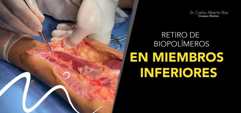 biopolímeros en miembros inferiores